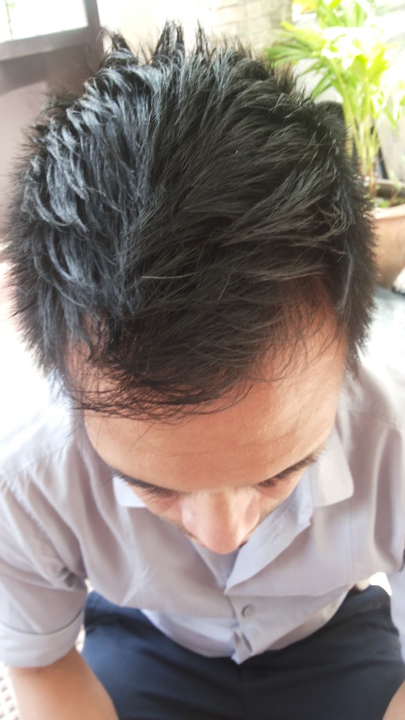 Andrew 2 Months Ago (Oct 2014)