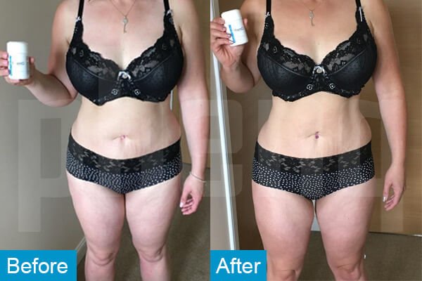 Nicola D Weigh loss Pills before After Phenq