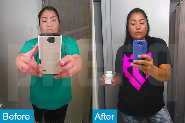 Valerie O Phenq Weight loss Pills Before and After